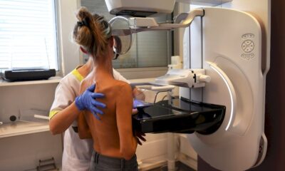 cancer-du-sein:-le-depistage,-utile-mais-parfois-survendu