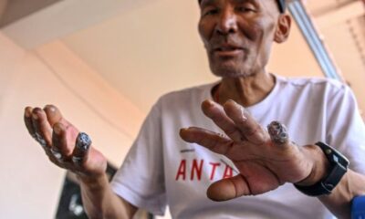 Dawa Sherpa le miraculé du toit du monde raconte sa survie