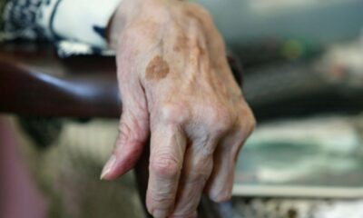 Près de la moitié des cas de démence pourraient être évités en changeant ces habitudes