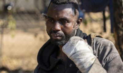 Passé à tabac, brûlé, pourchassé : l'exode forcé des Zimbabwéens fuyant l'Afrique du Sud