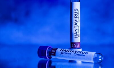 Un touriste porteur d'un virus rare, les proches appelés à s'isoler