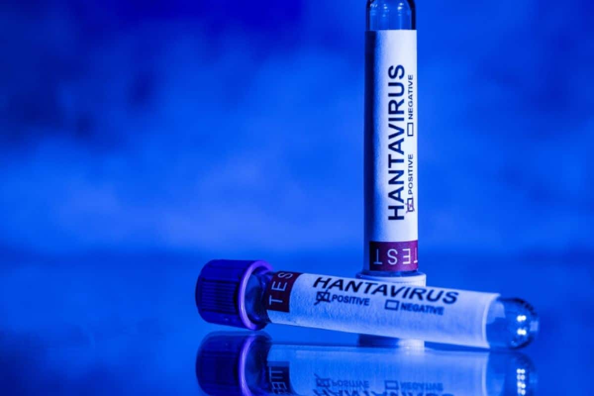 Un touriste porteur d'un virus rare, les proches appelés à s'isoler