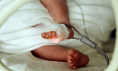 Un enfant prématuré sur six garde des difficultés à dix ans