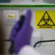 Le virus Shamonda atteint l’humain pour la première fois