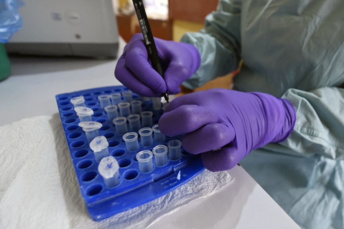 Le Nigeria confirme un cas d’Ebola et identifie 44 personnes contacts