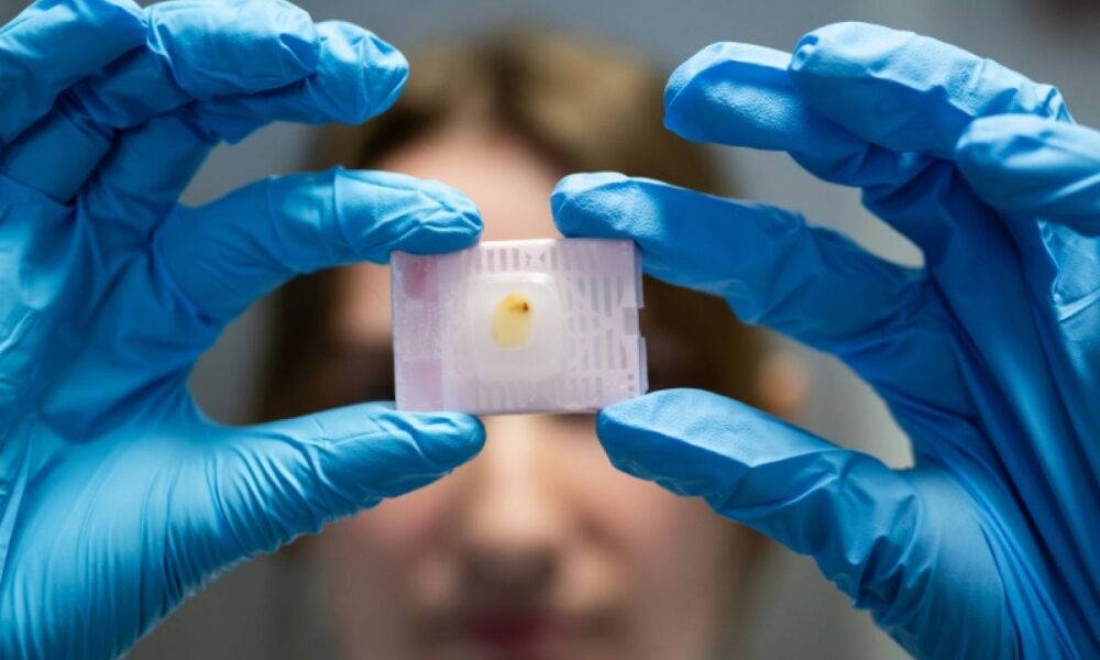 Ces chercheurs nantais veulent percer les secrets du cancer du sein des jeunes femmes
