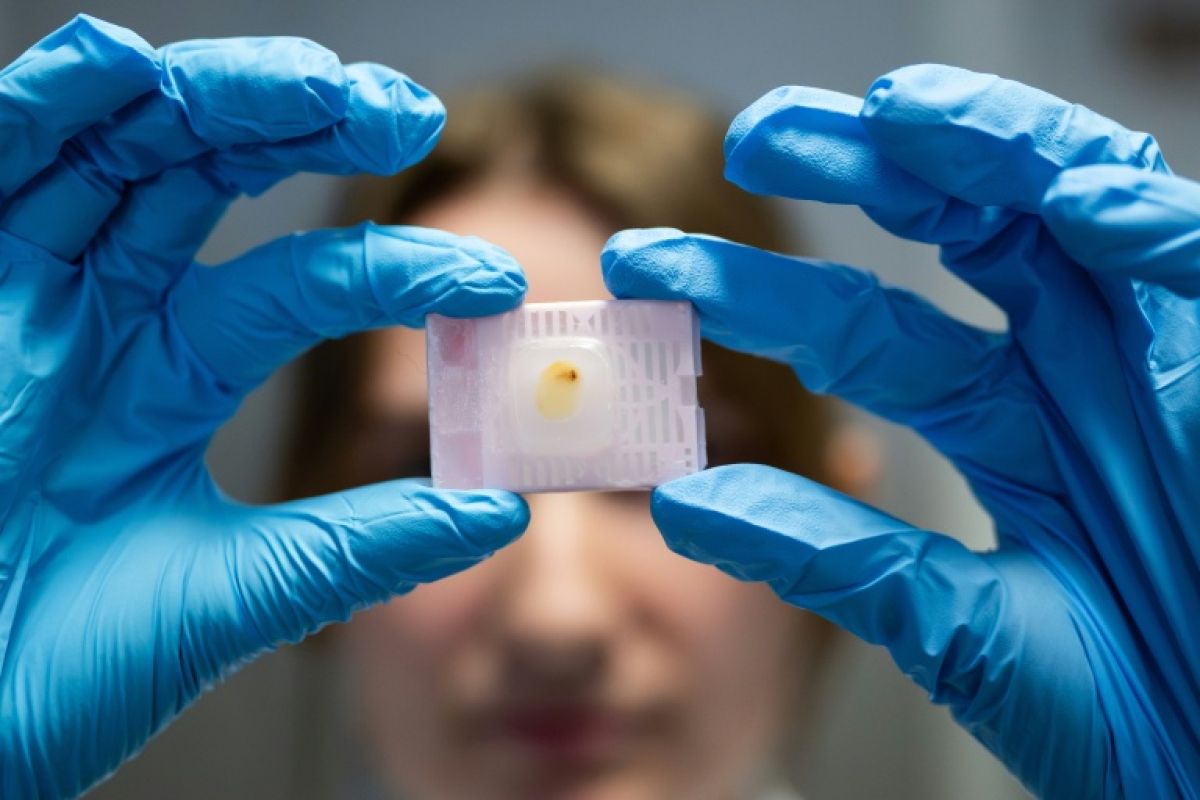 Ces chercheurs nantais veulent percer les secrets du cancer du sein des jeunes femmes