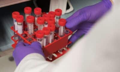 Une employée d'un laboratoire anti-peste est morte en Sibérie, l'OMS vérifie sans s'alarmer