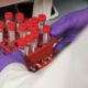 Une employée d'un laboratoire anti-peste est morte en Sibérie, l'OMS vérifie sans s'alarmer