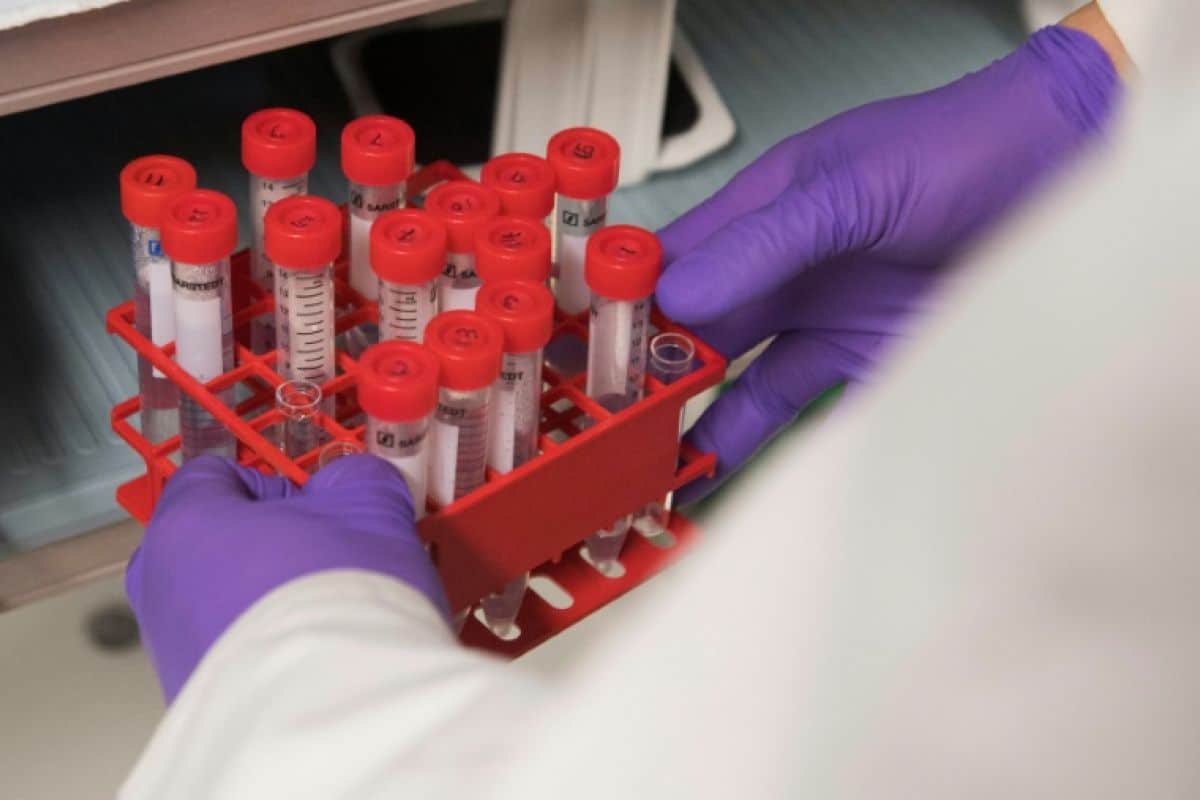 Une employée d'un laboratoire anti-peste est morte en Sibérie, l'OMS vérifie sans s'alarmer