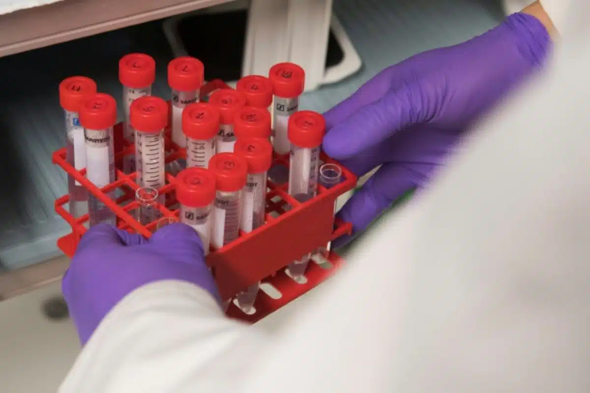 Une employée d'un laboratoire anti-peste est morte en Sibérie, l'OMS vérifie sans s'alarmer
