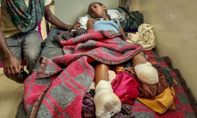 Au Tigré, ils ont dix ans et la guerre leur a pris leurs jambes