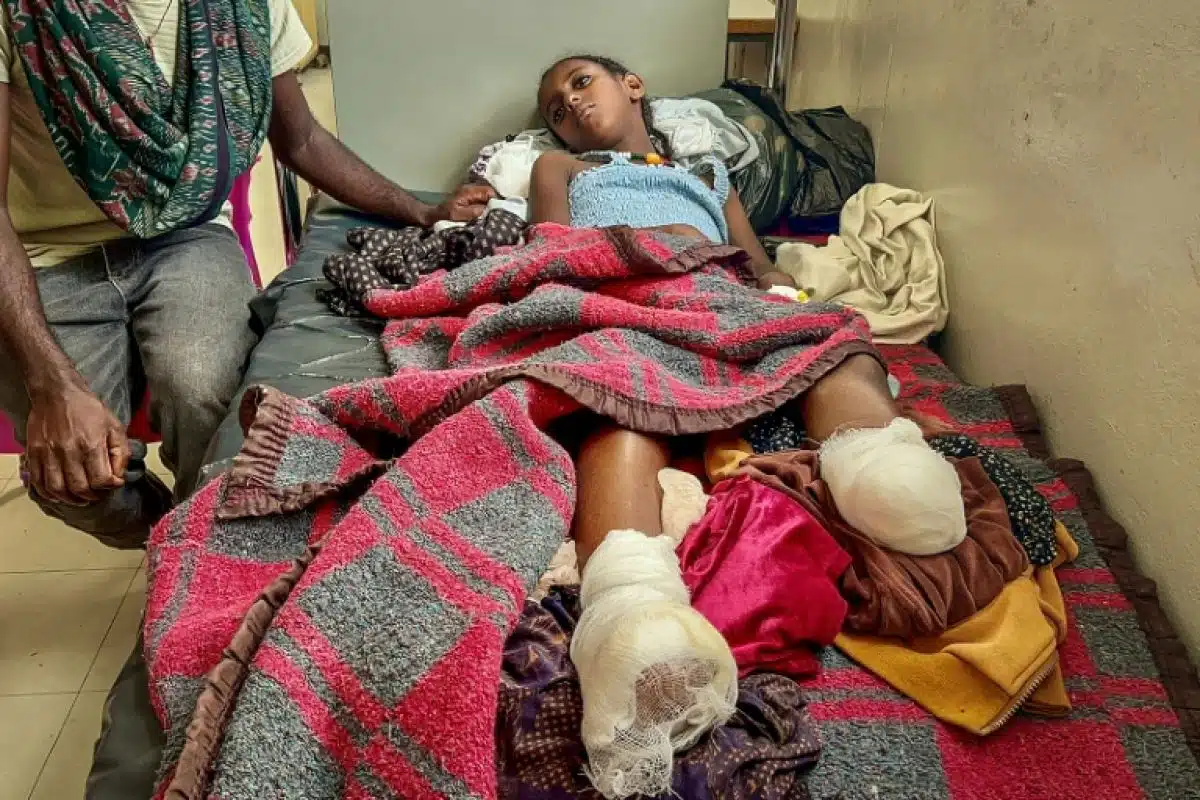 Au Tigré, ils ont dix ans et la guerre leur a pris leurs jambes